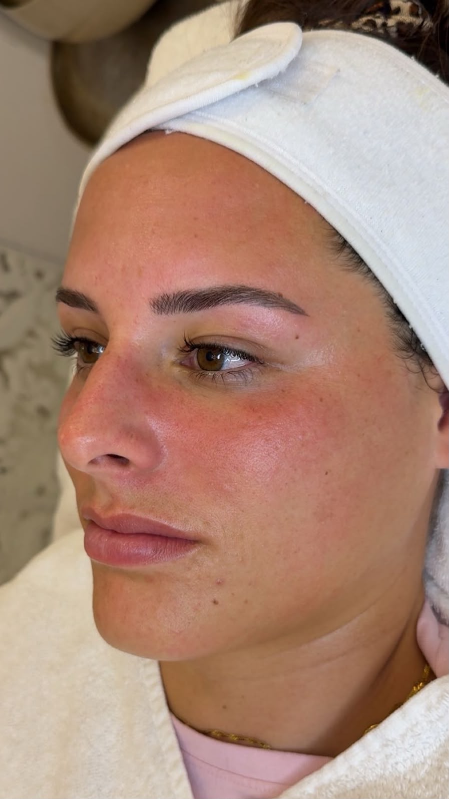 Haut nach dem Skin-Reset – Nahaufnahme Gesicht mit Stirnband