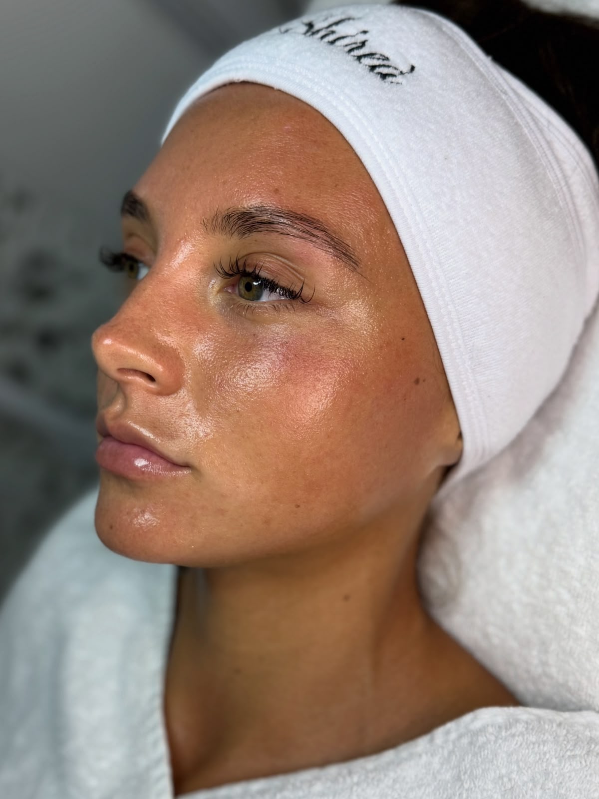 Haut nach dem Skin-Reset – Nahaufnahme Gesicht mit SHIREÁ-Stirnband