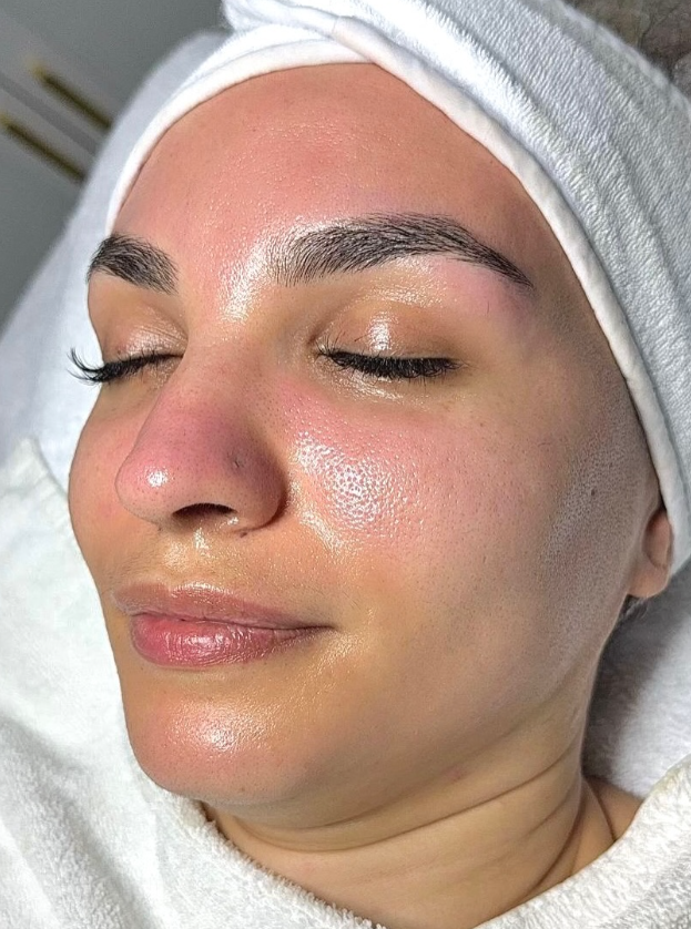 Haut nach dem Skin-Reset – Nahaufnahme frontal