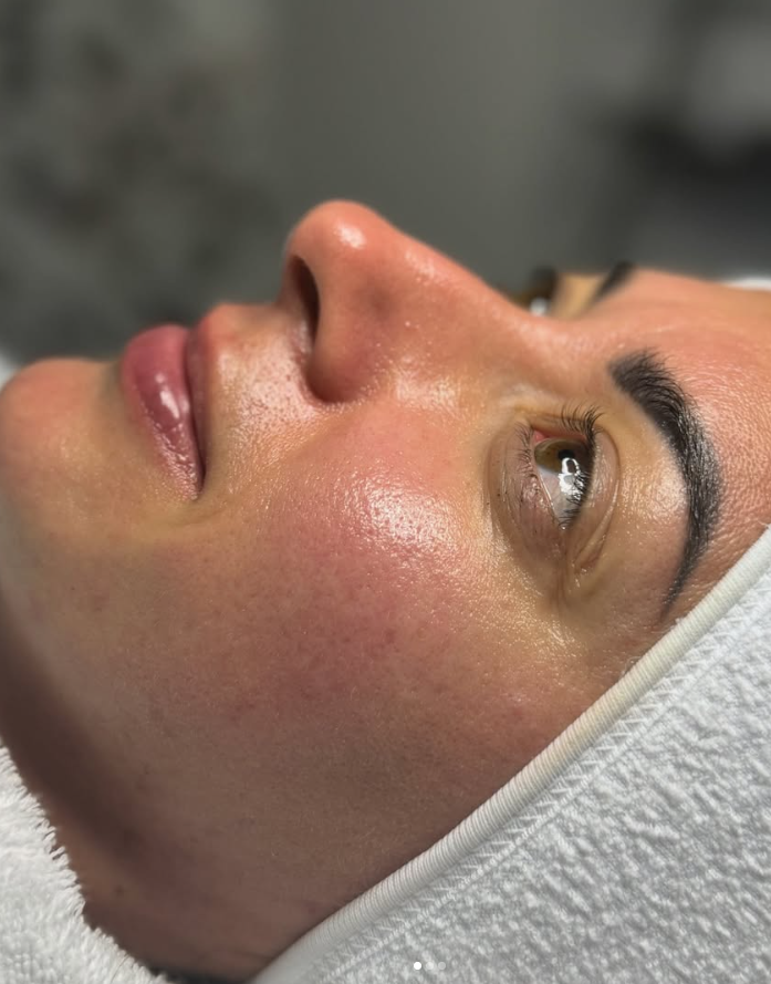 Haut nach dem Skin-Reset – Nahaufnahme seitlich
