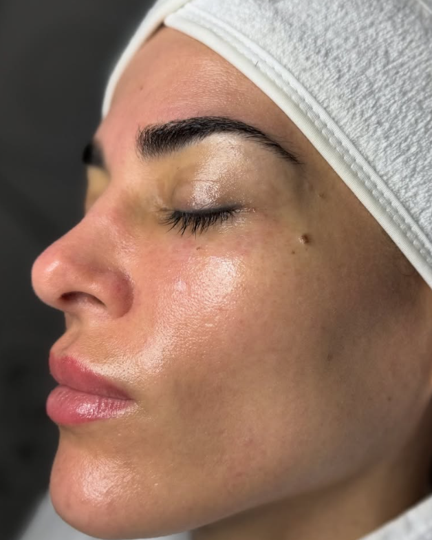Haut nach dem Skin-Reset – Nahaufnahme Profil