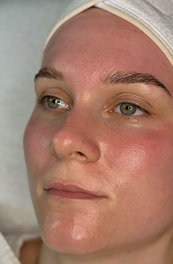 Haut nach dem Skin-Reset – Nahaufnahme mit geöffneten Augen
